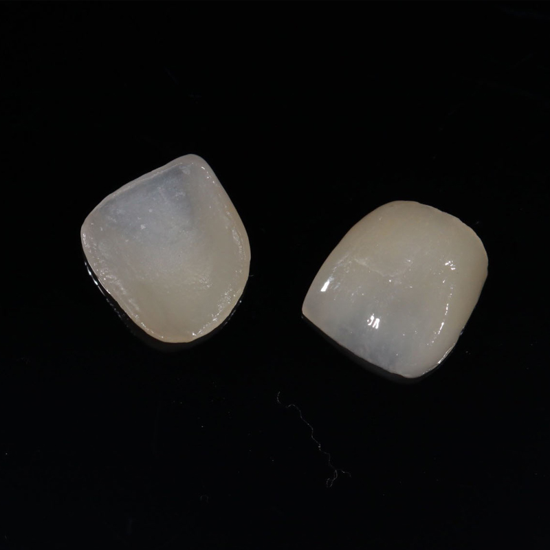 আইপিএস ইম্যাক্স প্রেস
