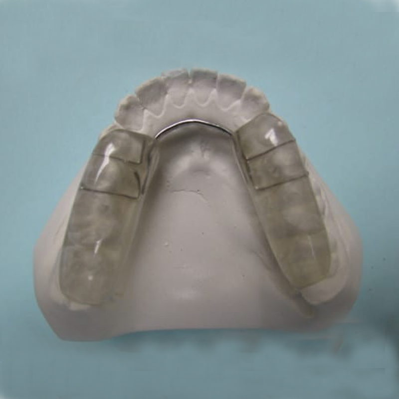 occlusal splints ভূমিকা