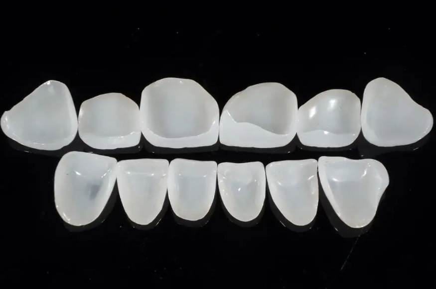 ডেন্টাল veneers এর সুবিধা কি কি?