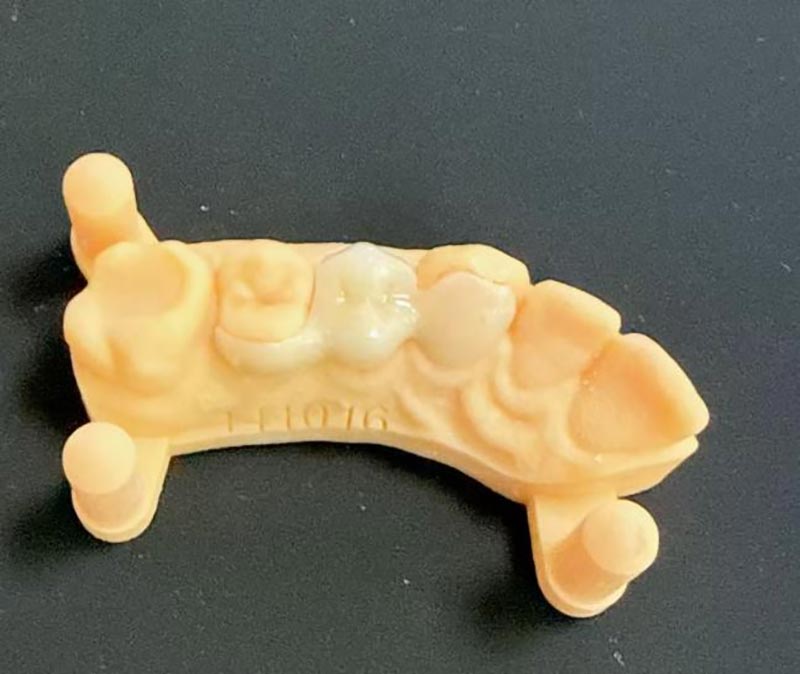 মেরিল্যান্ড ব্রিজ সম্পর্কে আপনার কী জানা দরকার?