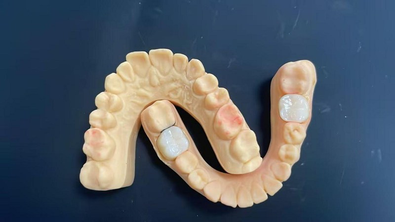 কাঁধের প্রান্ত কি?