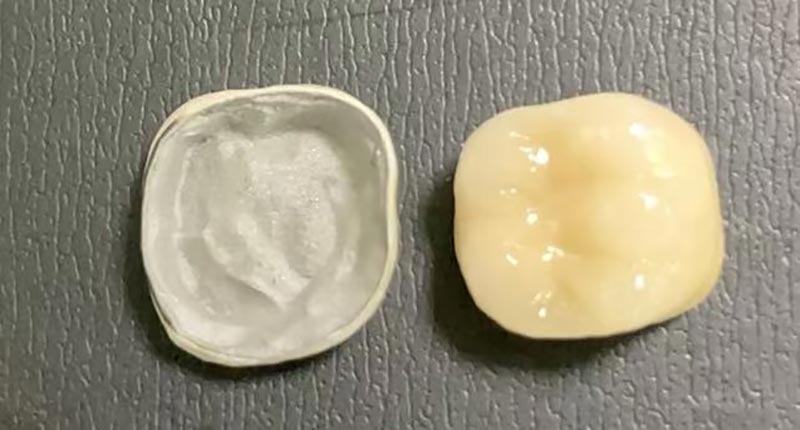 WM ডেন্টাল ল্যাব - একটি নেতৃস্থানীয় চীনা ডেন্টাল ল্যাব