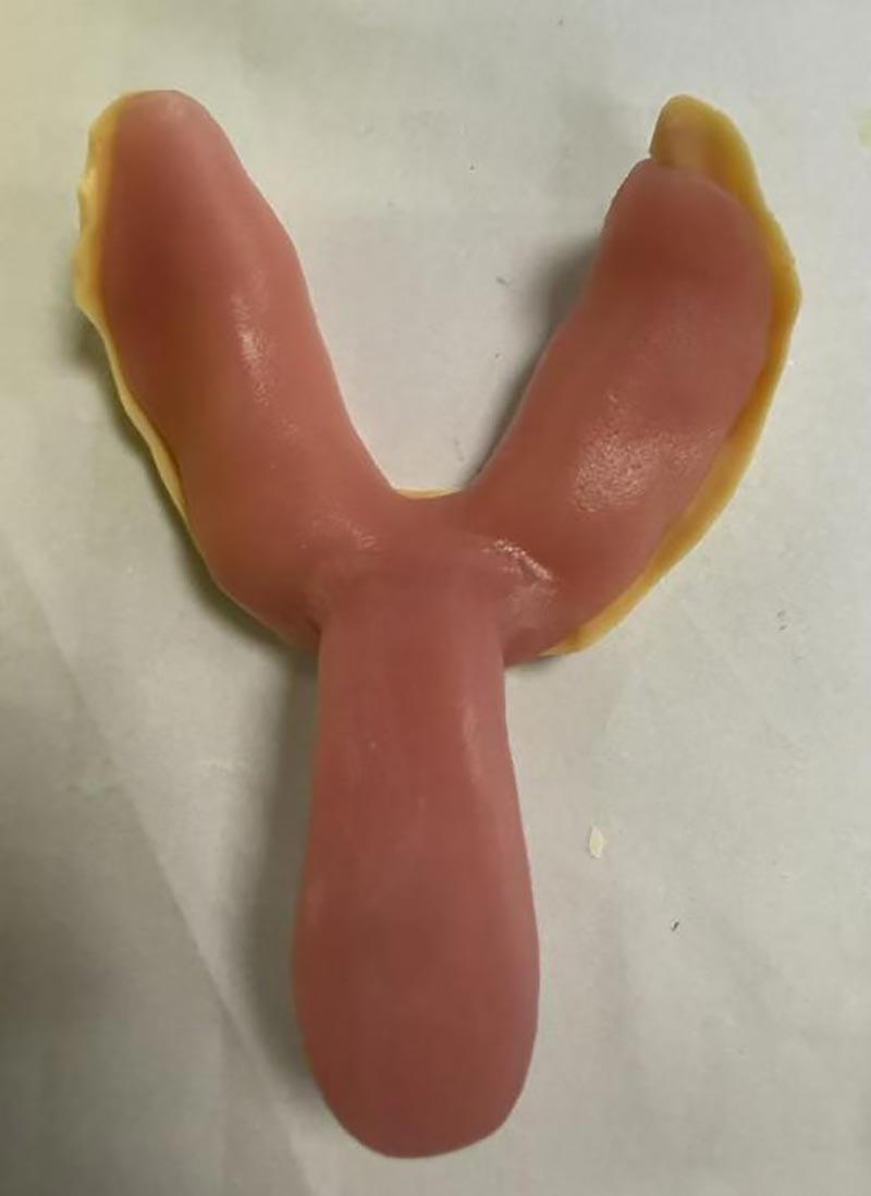 কাস্টম ডেন্টাল ট্রে সম্পর্কে আপনি যা জানেন না