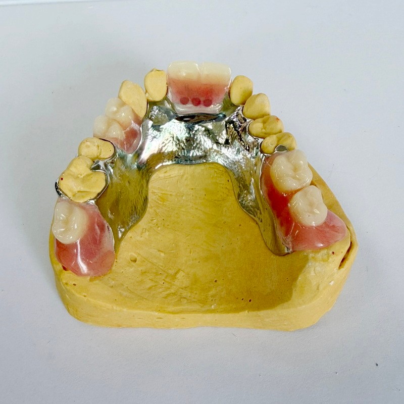 অপসারণযোগ্য পুনরুদ্ধার আংশিক ফ্রেমওয়ার্ক